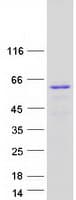 Human Spastin Protein (Recombinant Myc-DDK (Flag))