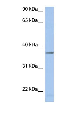 LDHAL6B Antibody (aa251-300)