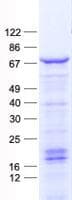 Human FOXC2 Protein (Recombinant His, N-Terminal)