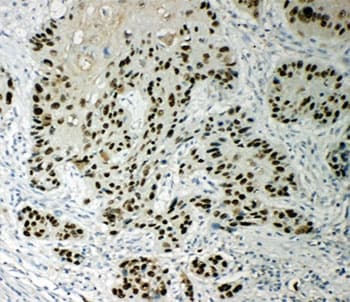 TP63 / p63 Antibody (aa664-680)