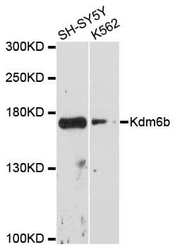 Polyclonal Rabbit anti-Mouse KDM6B / JMJD3 Antibody (WB)