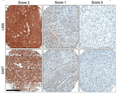 ROR2 Antibody (clone ROR2 2535-2835)