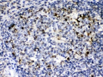 Polyclonal Rabbit anti-Human GC1qR / C1QBP Antibody (IHC, WB)