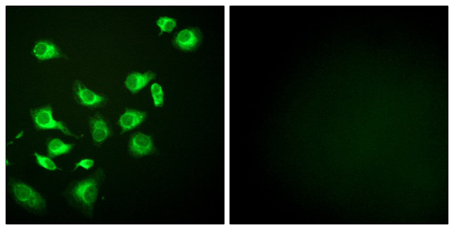 IHC-plus™ HSP90B1 / GP96 / GRP94 Antibody (aa754-803)