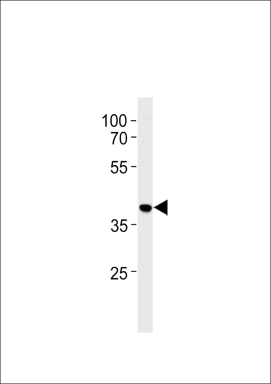 IHC-plus™ HNRNPAB Antibody (aa1-30)