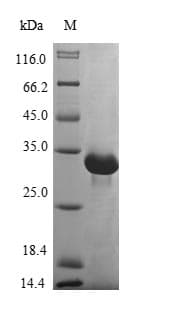 Human TK2 Protein (Recombinant 10His, N-terminus + Myc, C-terminus)