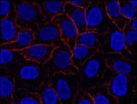 AHNAK Antibody (clone EM-09)