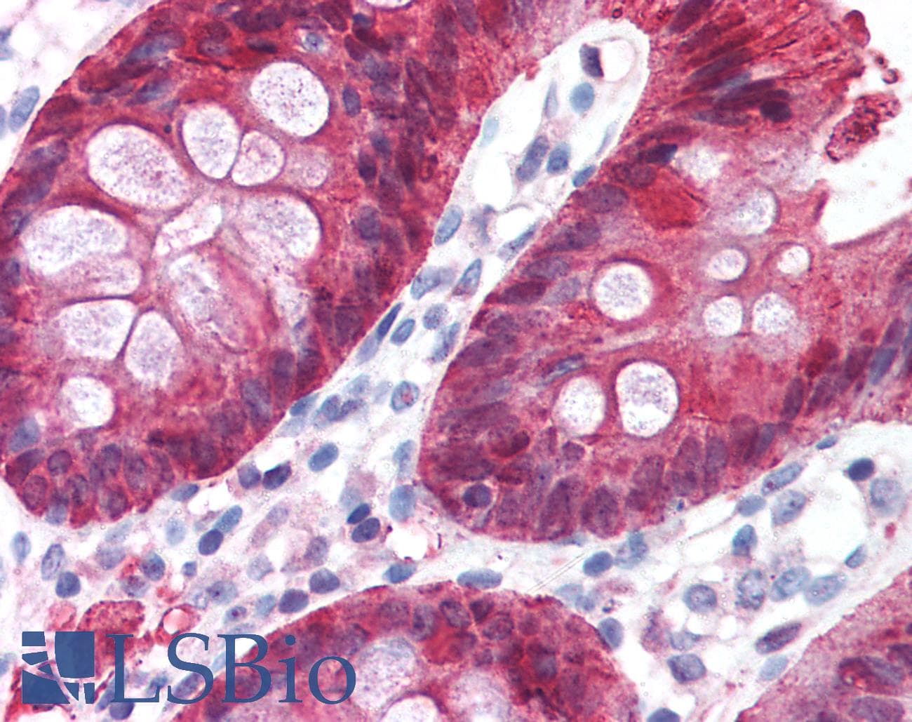 IHC-plus™ Polyclonal Rabbit anti-Human CA2 / Carbonic Anhydrase II Antibody (IHC, WB)
