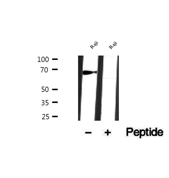 Polyclonal Rabbit anti-Human SLC38A3 / SNAT3 Antibody (IHC, IF, WB)