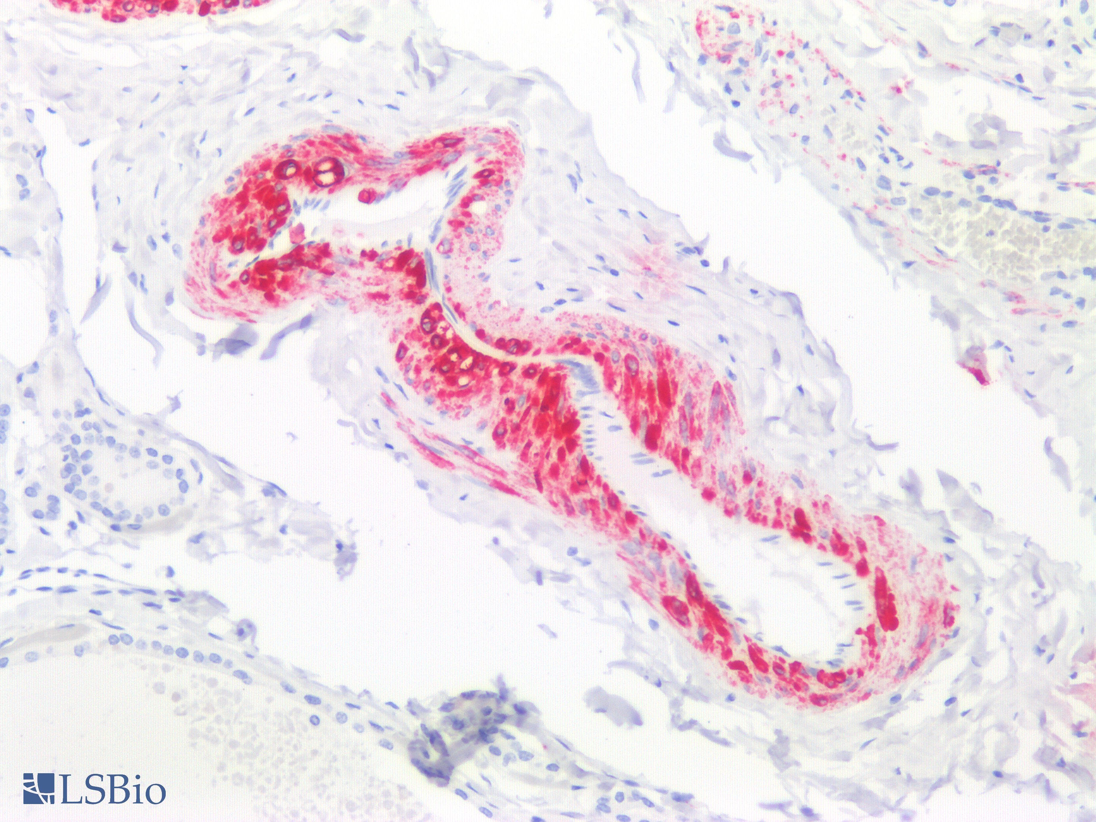 PathPlus™ Monoclonal Mouse anti-Human Myosin, Smooth Muscle Antibody (IHC)