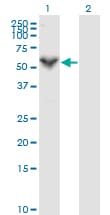 PRF1 / Perforin Antibody (aa461-555, clone 3B4)