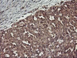 ERBB2 / HER2 Antibody (aa676-1255, clone OTI3F11, Carrier-free)