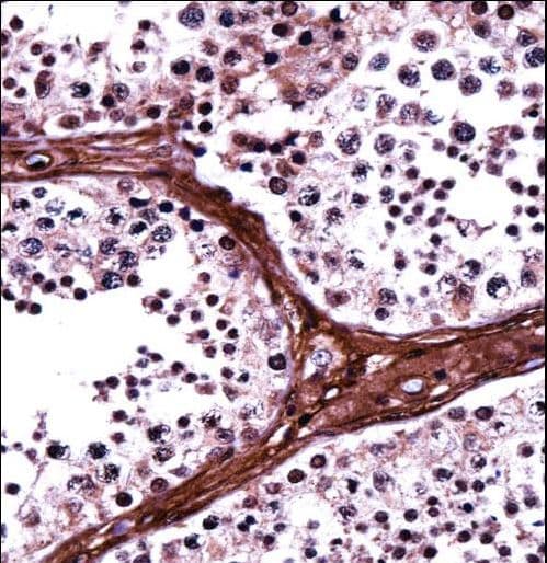 Polyclonal Rabbit anti-Human BRD1 Antibody (aa73-102, IHC, WB)