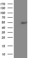 Monoclonal Mouse anti-Human CSNK1G2 / CKI-Gamma 2 Antibody (clone OTI5F4, aa163-415, WB)