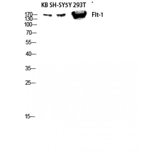 FLT1 / VEGFR1 Antibody (980-1060 aa)