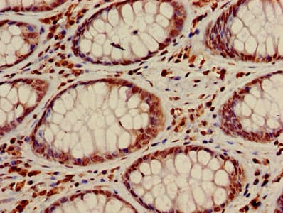 Polyclonal Rabbit anti-Human HIST1H3A Antibody (IHC, IF, WB)