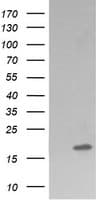 CTAG1B / NY-ESO-1 Antibody (clone OTI5A5)