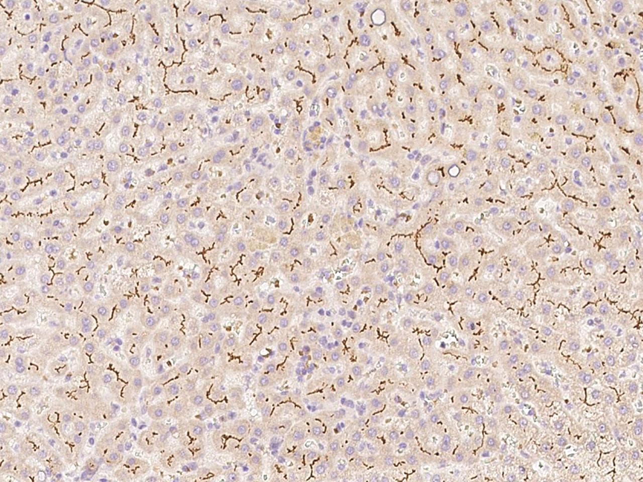 TRAIL-R4 / DCR2 Antibody (Preservative Free)