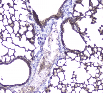 AQP5 / Aquaporin 5 Antibody