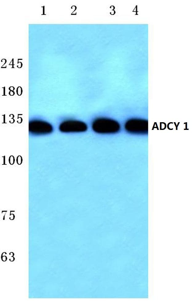 IHC-plus™ ADCY1 / Adenylate Cyclase 1 Antibody (aa230-280)