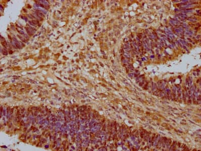 YWHAZ / 14-3-3 Zeta Antibody
