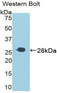 TIGIT Antibody (aa28-246, Cy3)