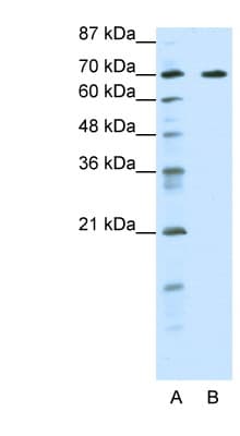 FOXK2 / ILF Antibody (aa491-540)