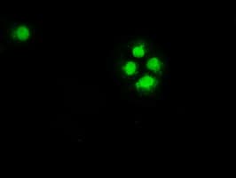 CHEK2 / CHK2 Antibody (clone OTI2F4)
