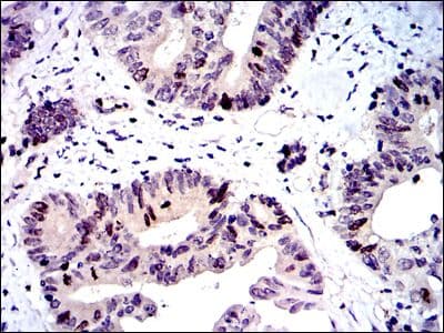 BIRC5 / Survivin Antibody (clone 1H5)