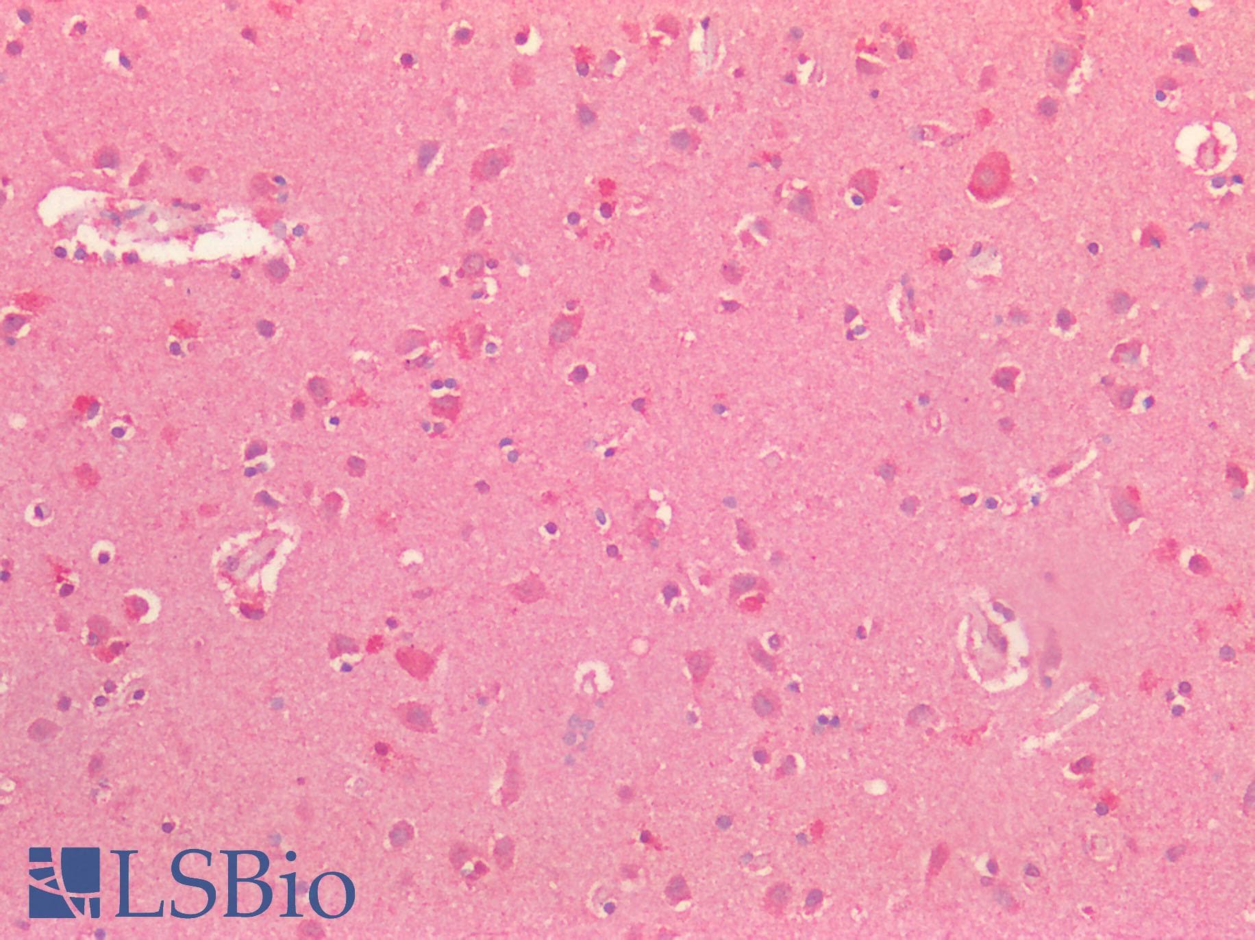 Polyclonal Rabbit anti-Human SIRPA / CD172a Antibody (aa31-373, IHC, IF)