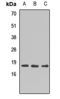 Polyclonal Rabbit anti-Human POLE4 / p12 Antibody (WB)