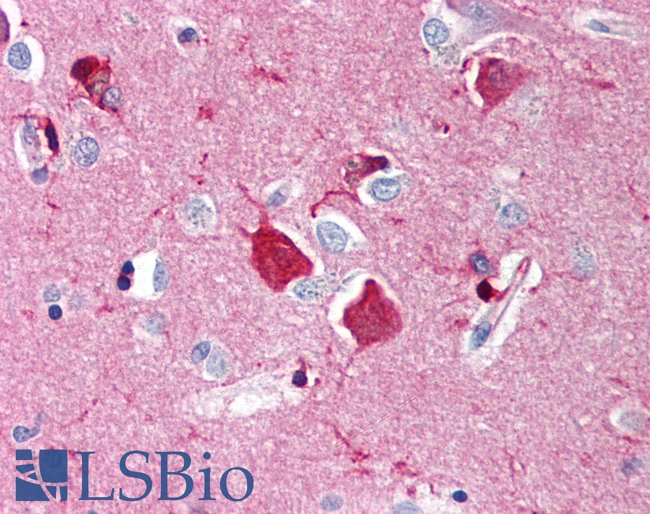 IHC-plus™ NGFR / CD271 / TNR16 Antibody