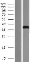 CD276 / B7-H3 Protein (Over-Expression Lysate Myc-DDK (Flag))
