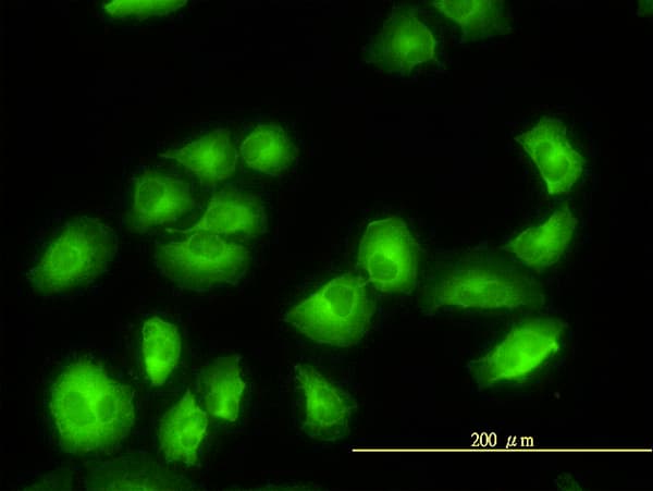 IHC-plus™ TUBA3C / Tubulin Alpha 3C Antibody (clone 3F10-2F2)