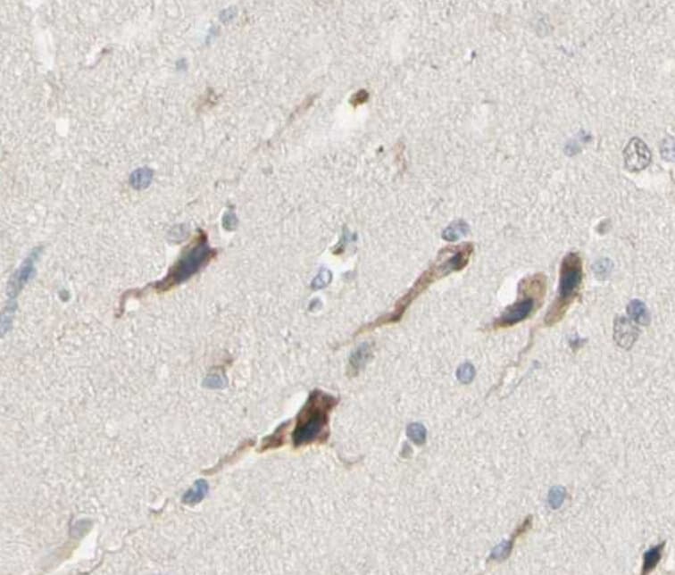 Polyclonal Rabbit anti-Human IL5 Antibody (IHC, WB)