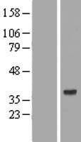 AMD / AMD1 Protein (Over-Expression Lysate Myc-DDK (Flag))