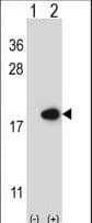 I-FABP / FABP2 Antibody (aa1-30)