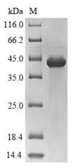 Human CD45 / LCA Protein (Recombinant 6His-SUMO, N-terminus)