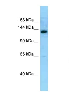 MN1 Antibody (aa1249-1298)