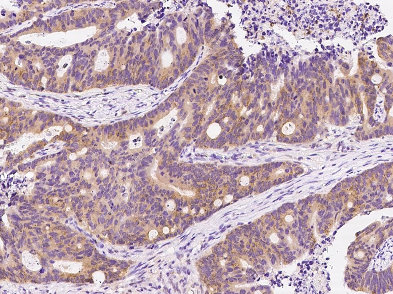 PDYN / ProDynorphin Antibody