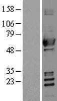 ALDH2 Protein (Over-Expression Lysate Myc-DDK (Flag))