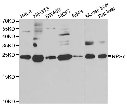 IHC-plus™ RPS7 / Ribosomal Protein S7 Antibody