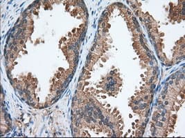 ERIC-1 / TACC3 Antibody (clone OTI7B11)