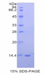 Human NRG2 Protein (Recombinant His)