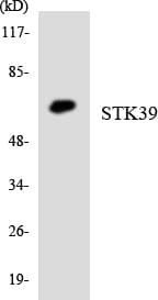 STK39 / SPAK Antibody (aa257-306)