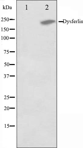 Dysferlin Antibody