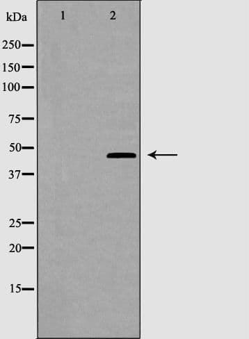 Polyclonal Rabbit anti-Human CRHR2 / CRF2 Receptor Antibody (IHC, IF, WB)