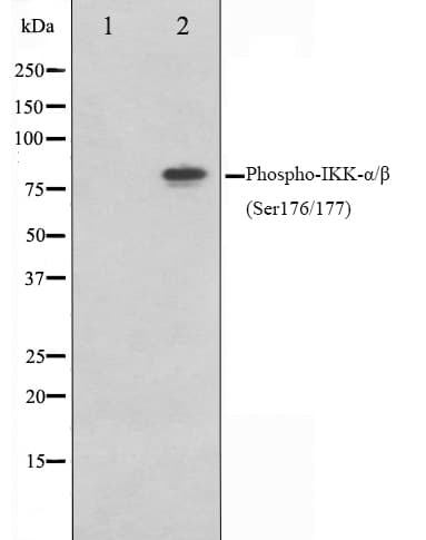 CHUK / IKKA / IKK Alpha Antibody (phospho-Ser176,pSer177)