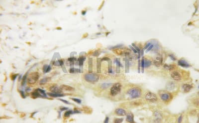 Polyclonal Rabbit anti-Human PTPN11 / SHP-2 / NS1 Antibody (IHC, IF, WB)