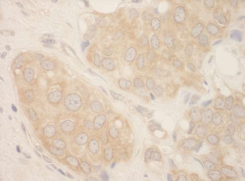 Polyclonal Rabbit anti-Human SRPK2 Antibody (aa425-475, IHC, IF)